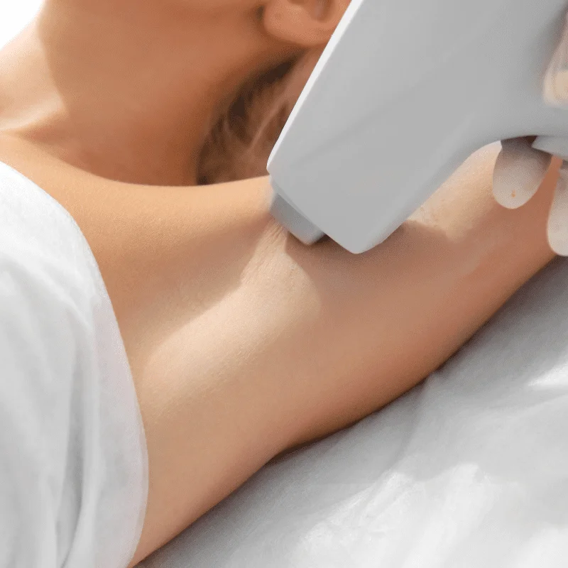 tarifs-forfait-epilation-laser-2-zones